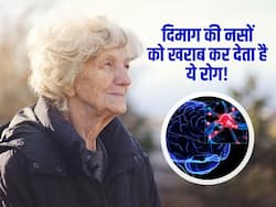 दिमाग की नसों को खराब करने वाली बीमारी जिसके शुरुआती लक्षण हैं बहुत आम, कहीं आपको तो महसूस नहीं हो रहे ये परेशानियां