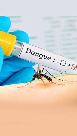 Dengue Cases Surge In West Bengal: 3 Deaths Reported In 72 Hours