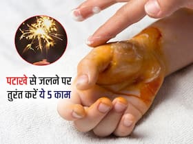 दिवाली 2022: पटाखे जलाते समय अगर जल जाए स्किन तो तुरंत करें ये 5 काम, दर्द और जलन से मिलेगी राहत
