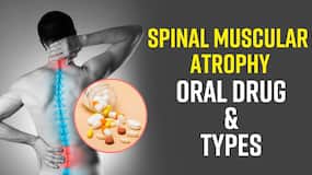 Spinal Muscular Atrophy In Children: Know About The Oral Drug In SMA, Expert Speaks, Watch Video