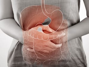 Gut Health And Stomach Cancer: The Role Of Diet And Microbiota In Prevention
