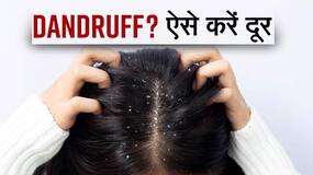Dandruff Home Remedies: सिर के डैंड्रफ को इन 5 आसान घरेलू उपायों से करें दूर, Watch Video