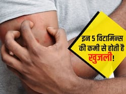 शरीर में इन 5 विटामिन्स की कमी से हो जाती है दाद-खाज और खुजली, जानें इन विटामिन्स की कमी को पूरा करने के सोर्स