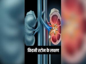 किडनी स्टोन का संकेत देते हैं ये 8 लक्षण