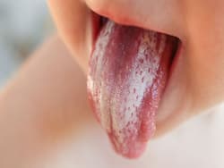 WHO Releases  List Of Deadly Infection-Causing Fungus: 19 Most Dangerous Of The Lot