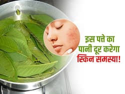 चेहरे पर दाग-धब्बे या फिर मुहांसे दूर करने के लिए लगाएं इस पत्ते का पानी, फेसवॉश से खुद कर लेंगे किनारा