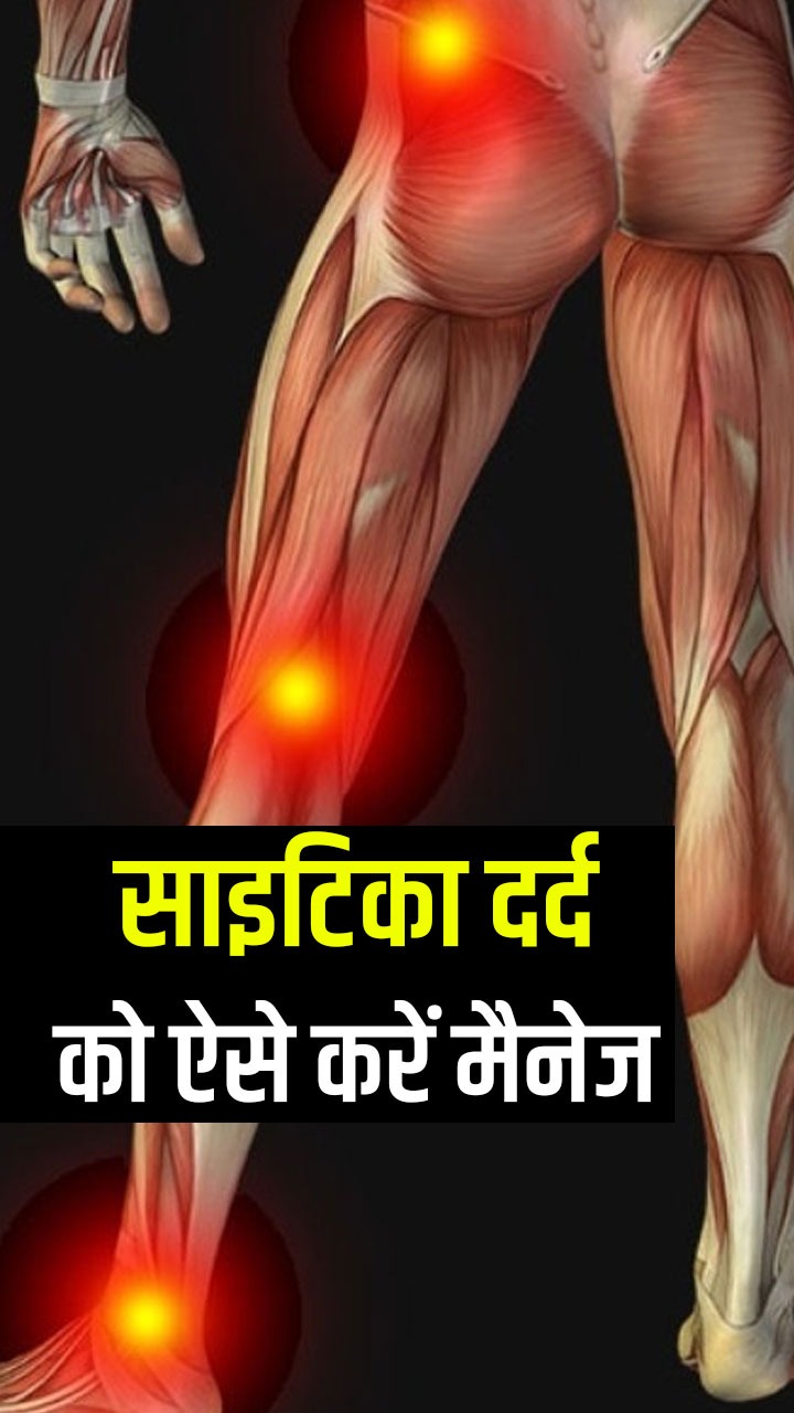 साइटिका दर्द को कम करने के 8 तरीके