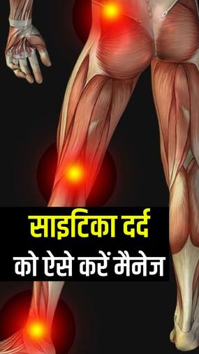 साइटिका दर्द को कम करने के 8 तरीके