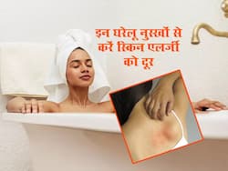 बार-बार हो रही है स्किन एलर्जी तो घर पर मौजूद इन 3 घरेलू उपाय से करें ठीक, लेकिन इन बातों का रखें खास ध्यान