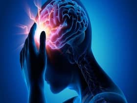 Transient Ischemic Attack: A Condition That Mimics Stroke And Must Never Be Ignored