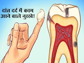 दवा खाने के बाद भी कम नहीं हो रहा दांद का दर्द? इन 3 देसी नुस्खों को आजमाते ही मिलेगा दर्द से तुरंत आराम