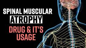 Spinal Muscular Atrophy: Suitable Treatment & Drug For SMA, Expert Speaks, Watch Video