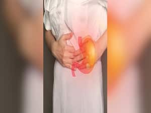 10 Facts About Stomach Cancer That You Should Be Aware Of