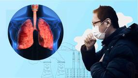 Air Pollution Can Damage Your Lungs, Cause Acute Bronchitis: 10 Warning Symptoms You Should Know