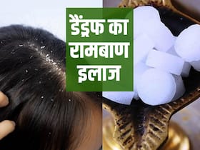 सिर में पपड़ी और डैंड्रफ का पक्का इलाज है कपूर, जानिए इस्तेमाल का सही तरीका