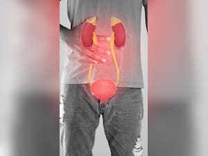 People With Kidney Disease: Dos And Don’ts