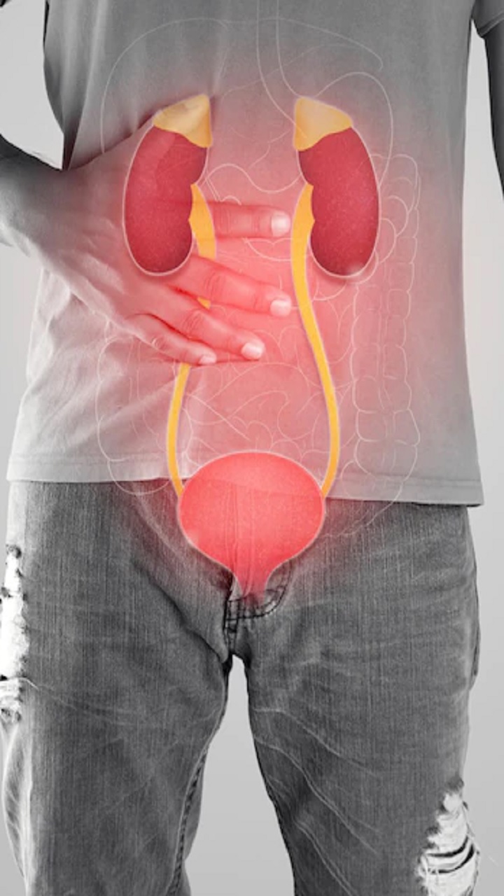 People With Kidney Disease: Dos And Don’ts