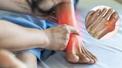 Gout Spikes: 5 Foods That Can Instantly Trigger Your Risk of Uric Acid