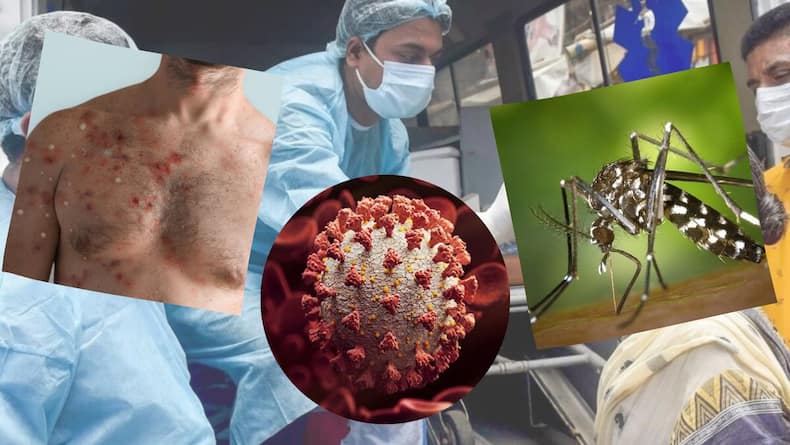 Can Vaccine Eliminate Measles And Rubella Infection?