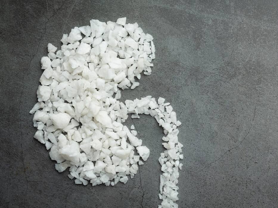 Eating Too Much Salt Can Cause These Health Problems