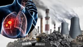 Lung Cancer On The Rise In India, Experts Say Air Pollution Is The Root Cause: Key Points To Know