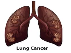 Is Lung Cancer Prevalent In Older Adults? 4 Prevention Tips