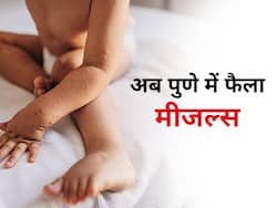 मुंबई के बाद पुणे में भी बढ़े मीजल्स के मामले,बच्चों के हेल्थ और सेफ्टी को ले बढ़ी पेरेंट्स की चिंता