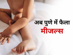 मुंबई के बाद पुणे में भी बढ़े मीजल्स के मामले,बच्चों के हेल्थ और सेफ्टी को ले बढ़ी पेरेंट्स की चिंता मुंबई के बाद पुणे में भी बढ़े मीजल्स के मामले,बच्चों के हेल्थ और सेफ्टी को ले बढ़ी पेरेंट्स की चिंता