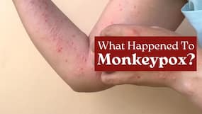 What Happened To Monkeypox? Who Are Still At Risk of This Deadly Virus Attack
