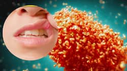 New Monkeypox Symptom: Ulcer At Mouth's Corner Can Be 1st Sign of Monkeypox Infection