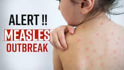 Measles Outbreak: 6 Cases Of Measles Found In India, Health Experts Warn, Watch Video