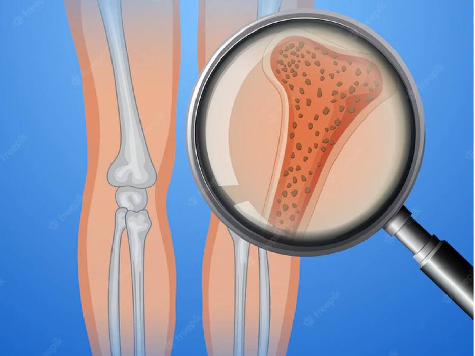 Eating Too Much Salt Can Cause These Health Problems