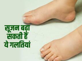 शरीर में सूजन बढ़ा सकती हैं ये 3 गलतियां, सुबह उठते ही करने से बचें