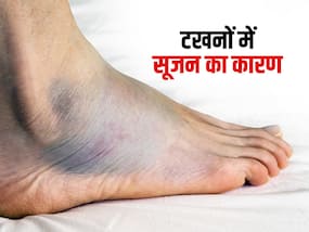 इन बीमारियों के कारण हो सकती है आपके टखनों में सूजन, जानें और नजरअंदाज ना करें