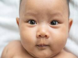 Why Newborns Are Myopic, Ways To Identify And Treat It