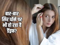 सिर धोते समय सिर्फ एक गलती के कारण होने लगता है डैंड्रफ, इन 3 घरेलू तरीकों से करें दूर
