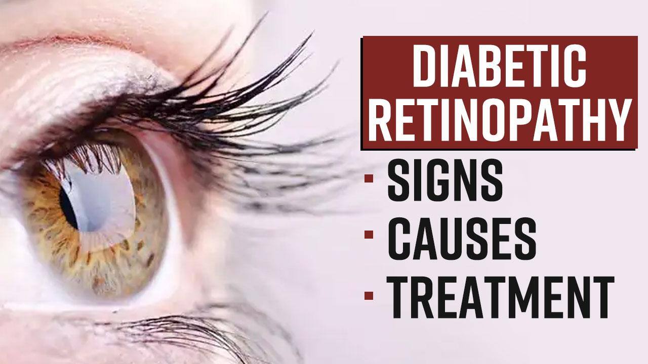Diabetic Retinopathy DiabetesRelated Retinopathy Can Lead To Vision