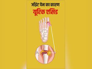 यूरिक एसिड कम करने के लिए क्या खाना चाहिए?