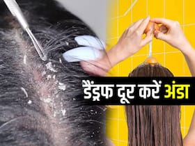 डैंड्रफ होने पर बालों में अंडा कैसे लगाएं? जानें अंडे का हेयरमास्क बनाने के ​5 बेस्ट तरीके