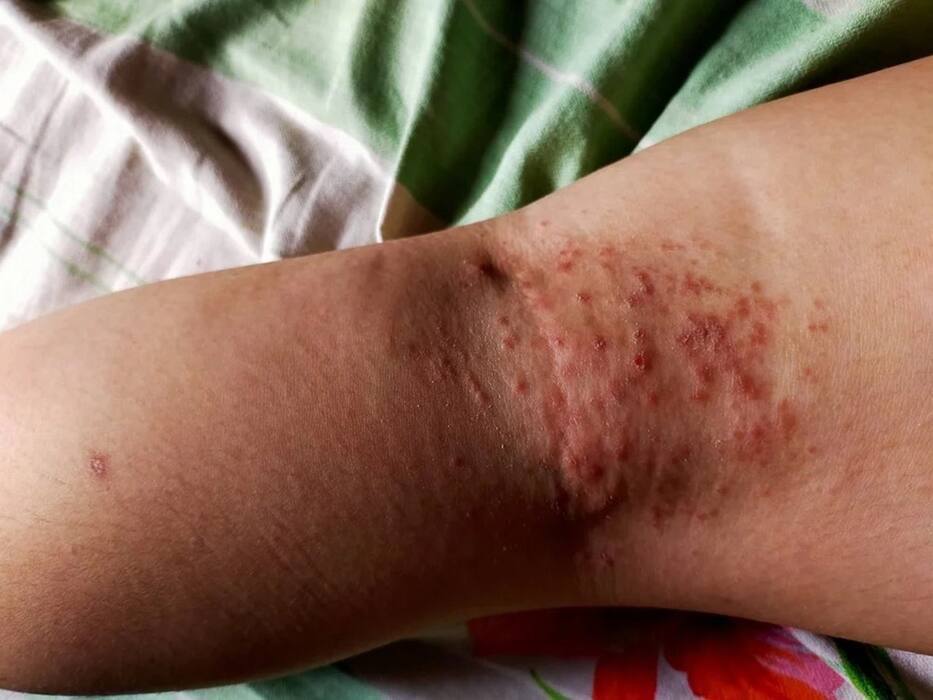 5 लक्षण को नजरअंदाज करने से 'साइलेंट किलर' बन जाता है High Blood sugar! जानें किस गलती से बिगड़ती है डायबिटीज