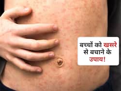बच्चों को खसरा (measles) से बचाने के लिए माता-पिता करें ये 7 उपाय! जानें बच्चों के लिए आसान सेफ्टी टिप्स