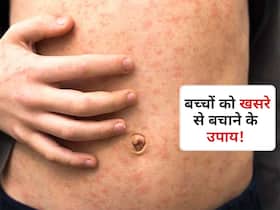 बच्चों को खसरा (measles) से बचाने के लिए माता-पिता करें ये 7 उपाय! जानें बच्चों के लिए आसान सेफ्टी टिप्स बच्चों को खसरा (measles) से बचाने के लिए माता-पिता करें ये 7 उपाय! जानें बच्चों के लिए आसान सेफ्टी टिप्स