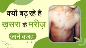 Measles virus: कोविड महामारी के बाद खसरा भारत में अपने पैर पसार रहा है, WHO ने दी चेतावनी, Watch Video