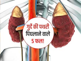 गुर्दे की पथरी को पिघलाने का काम करते हैं ये 5 सस्ते फल! खाते ही पथरी का नामोंनिशान होने लगता है साफ गुर्दे की पथरी को पिघलाने का काम करते हैं ये 5 सस्ते फल! खाते ही पथरी का नामोंनिशान होने लगता है साफ