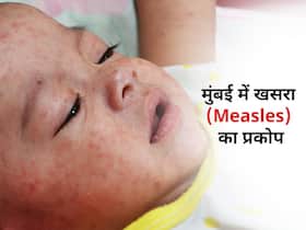 Mumbai Measles Outbreak: मुंबई में खसरे से 8 की मौत की आशंका, महिलाएं और बच्चे हो रहे संक्रमण का शिकार Mumbai Measles Outbreak: मुंबई में खसरे से 8 की मौत की आशंका, महिलाएं और बच्चे हो रहे संक्रमण का शिकार