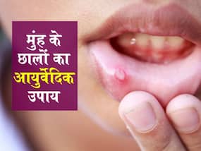 इन 3 पोषक तत्वों की कमी से होता है माउथ अल्सर, मुंह के छालों की तकलीफ कम करेंगे ये 2 आयुर्वेदिक उपाय