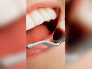 4 Ways Of Preventing Tooth Decay