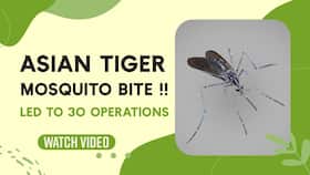 Asian Tiger Mosquito Bite: Man Undergoes 30 Operations, After Mosquito Bite, Watch Video Asian Tiger Mosquito Bite: Man Undergoes 30 Operations, After Mosquito Bite, Watch Video
