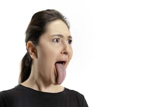 White Tongue: 5 Reasons Why You Could Have It