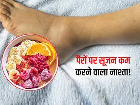 सुबह उठने पर पैरों में सूजन तो नाश्ते में खाएं ये 5 चीजें! 1 से 2 घंटे में उतर जाएगी हाथ-पैरों पर चढ़ी सूजन